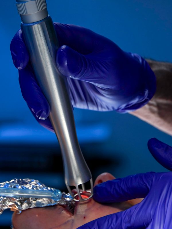 Laser handpiece held close to the skin
